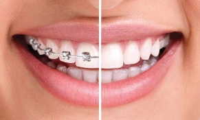 Orthodontics