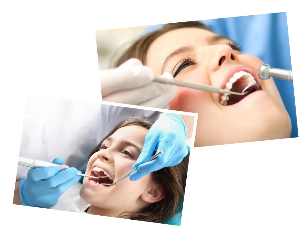 Teeth Filling
