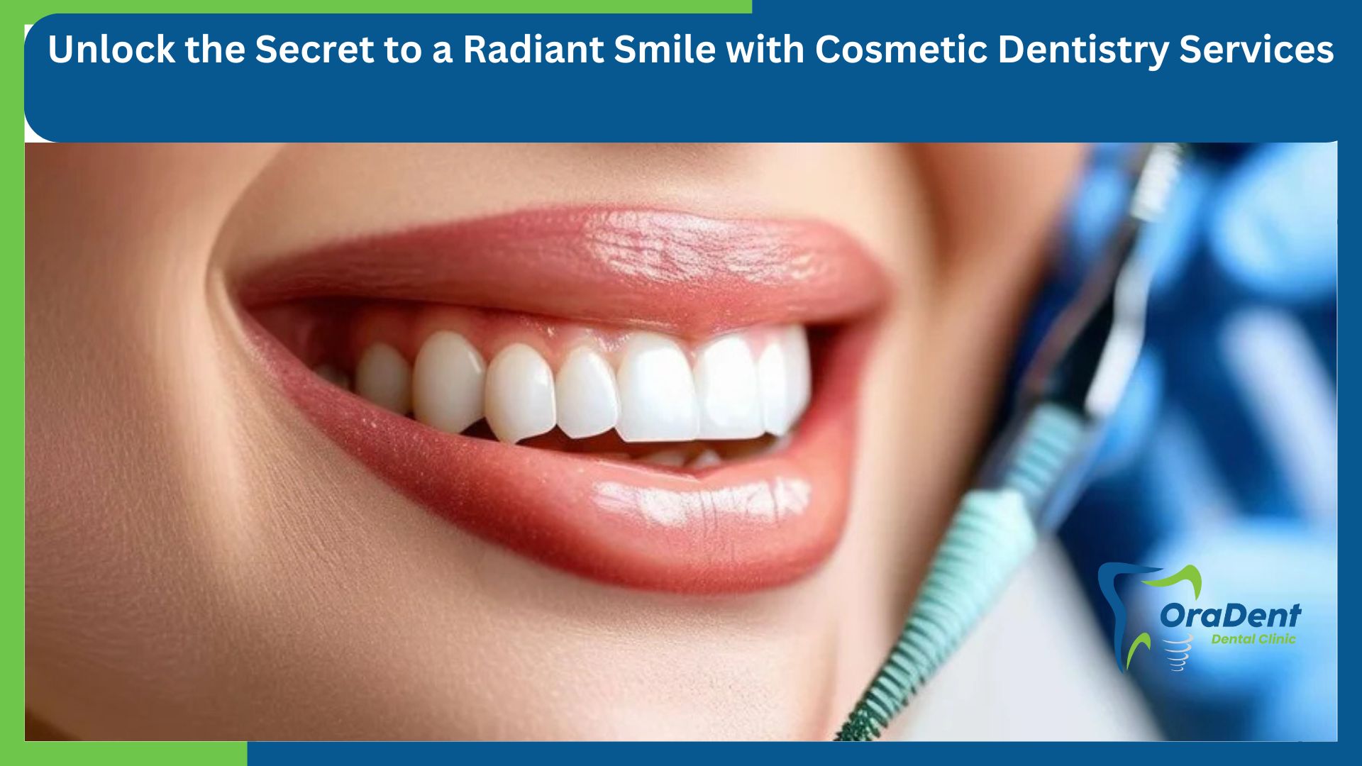 Surprising Truth About Professional Teeth Whitening: Is It Worth the Investment?