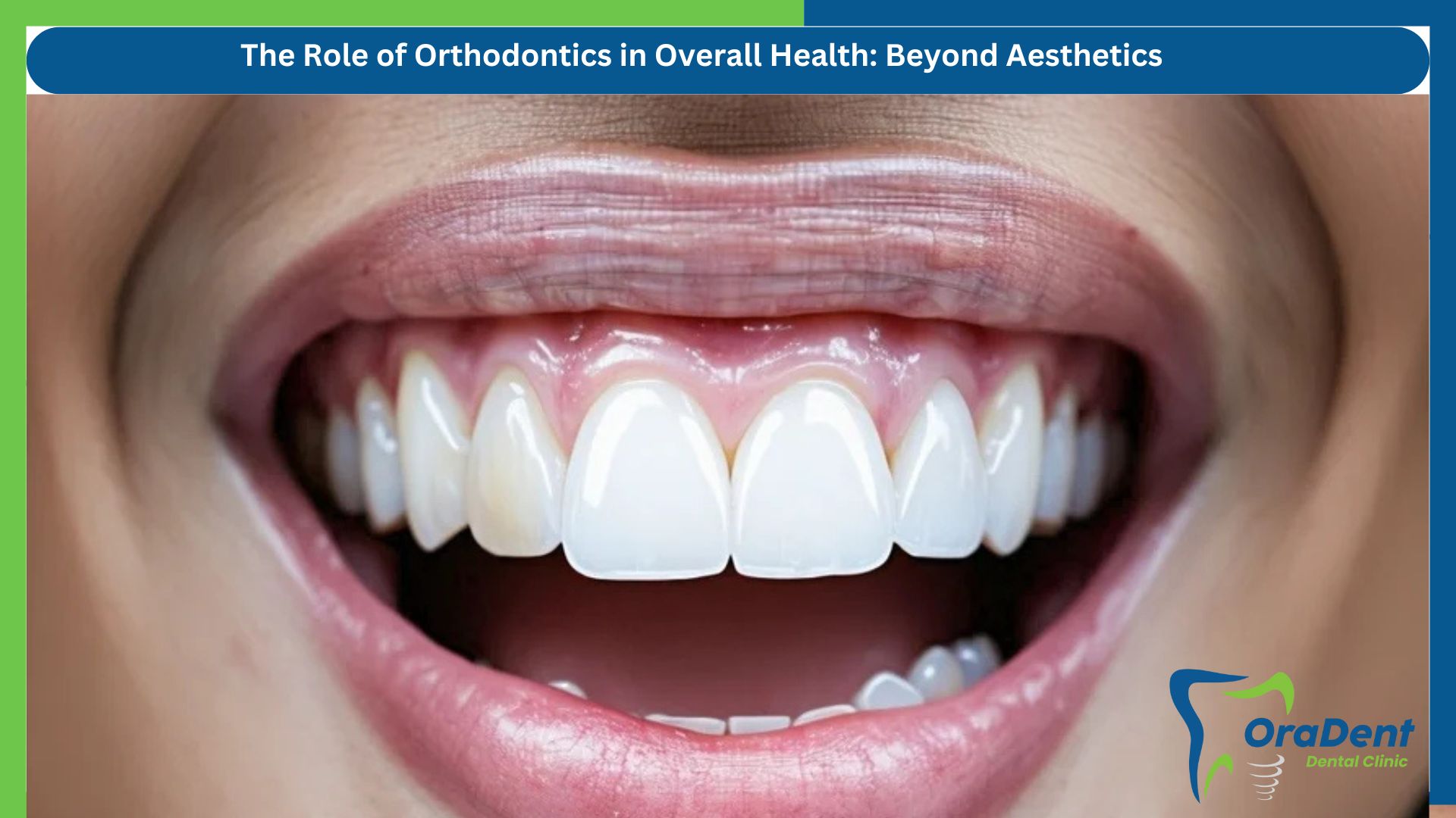 The Role of Orthodontics in Overall Health: Beyond Aesthetics