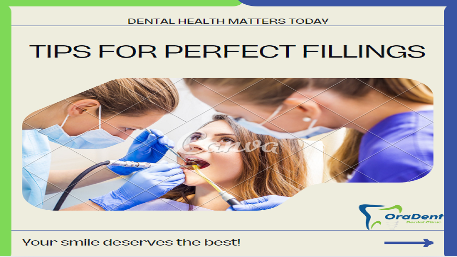 Tips for a Comfortable Teeth Filling Experience: Expert Advice from Dentists